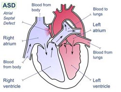 diagram of a heart