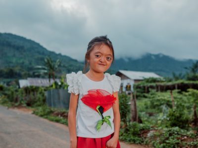 A photo of a girl with Apert syndrome in a white shirt with a flower on it standing on a road in front of a village and mountain.