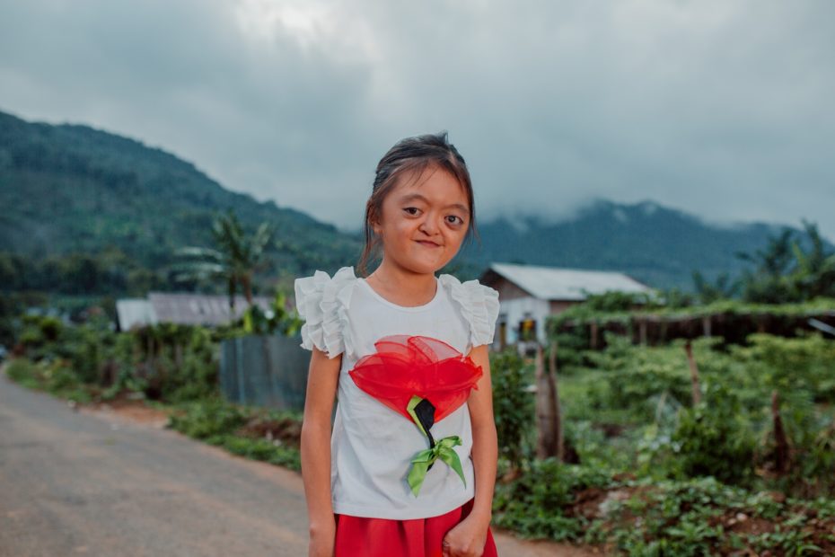 A photo of a girl with Apert syndrome in a white shirt with a flower on it standing on a road in front of a village and mountain.