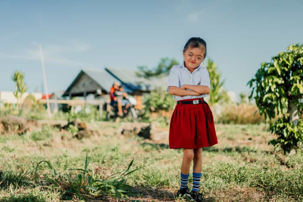 A photo of a girl with Apert Syndrome in a red and white school uniform stands in front of a house, with her arms crossed in front of her.