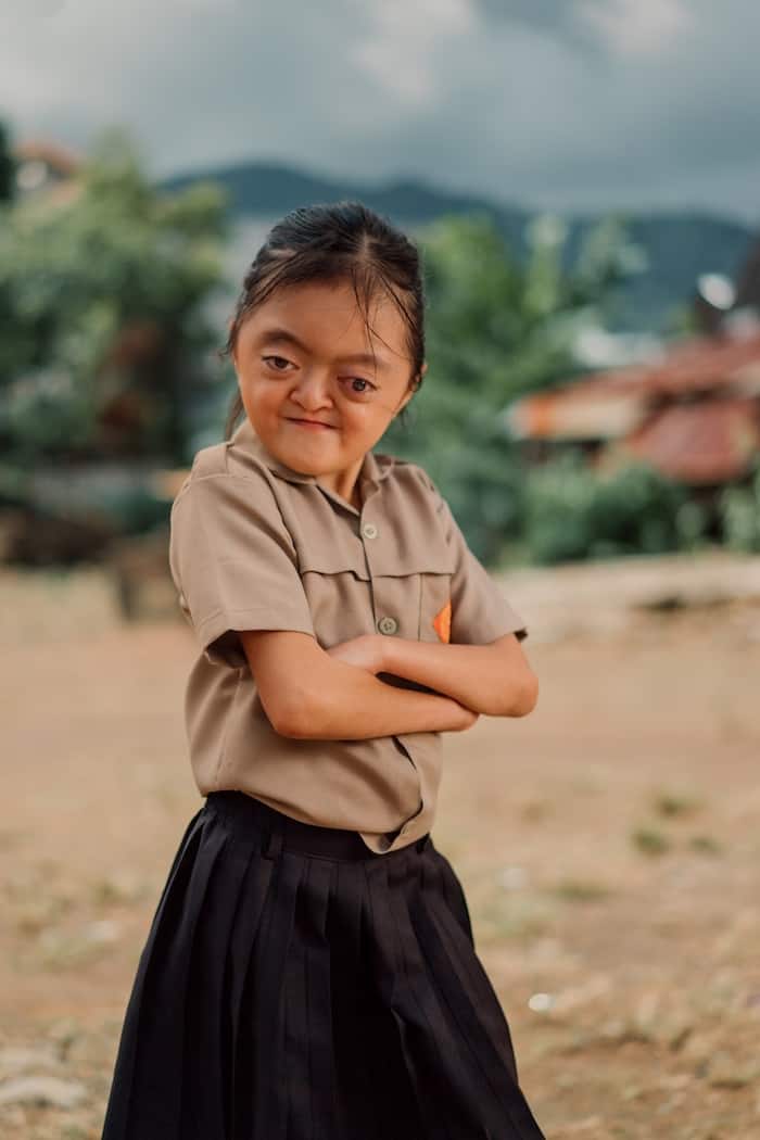A photo of a girl with Apert Syndrome with her arms crossed in front of her, wearing a brown school uniform.