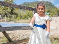 A girl with limb difference wearing a white dress with a blue sash leans against a fence.