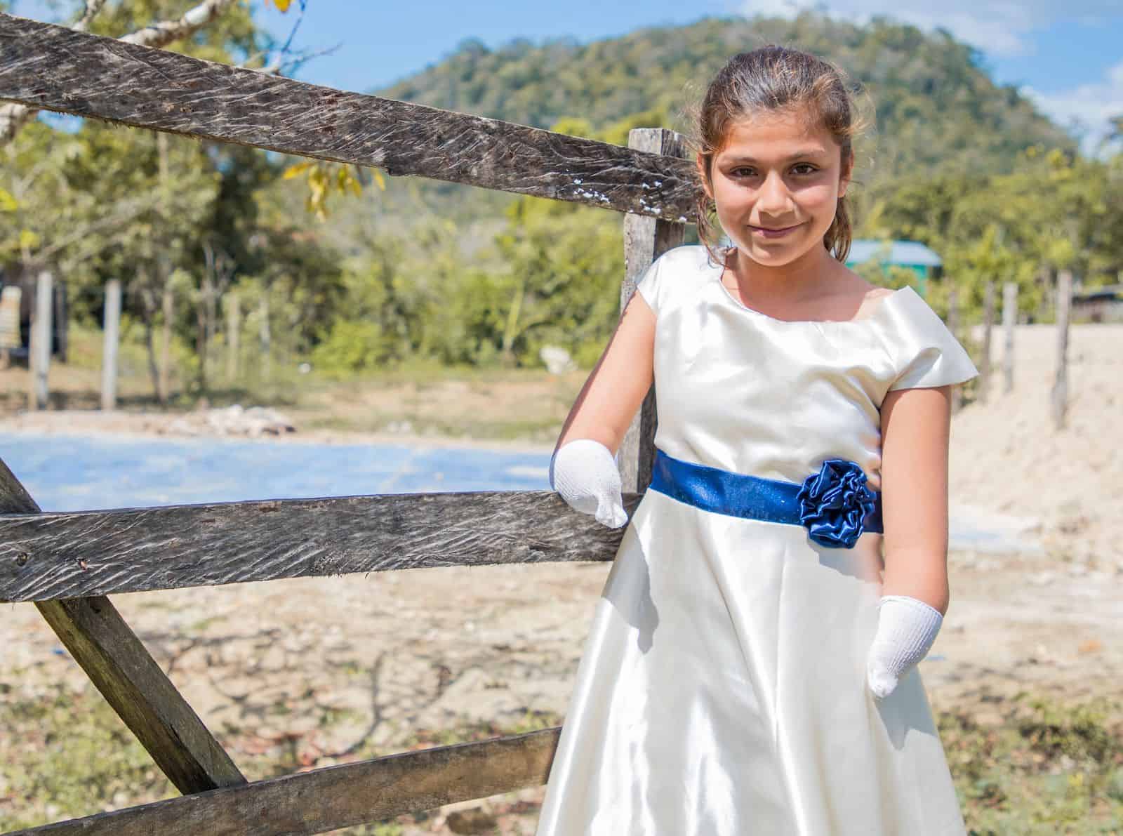 A girl with no hands wearing a white dress with a blue sash leans against a fence. 